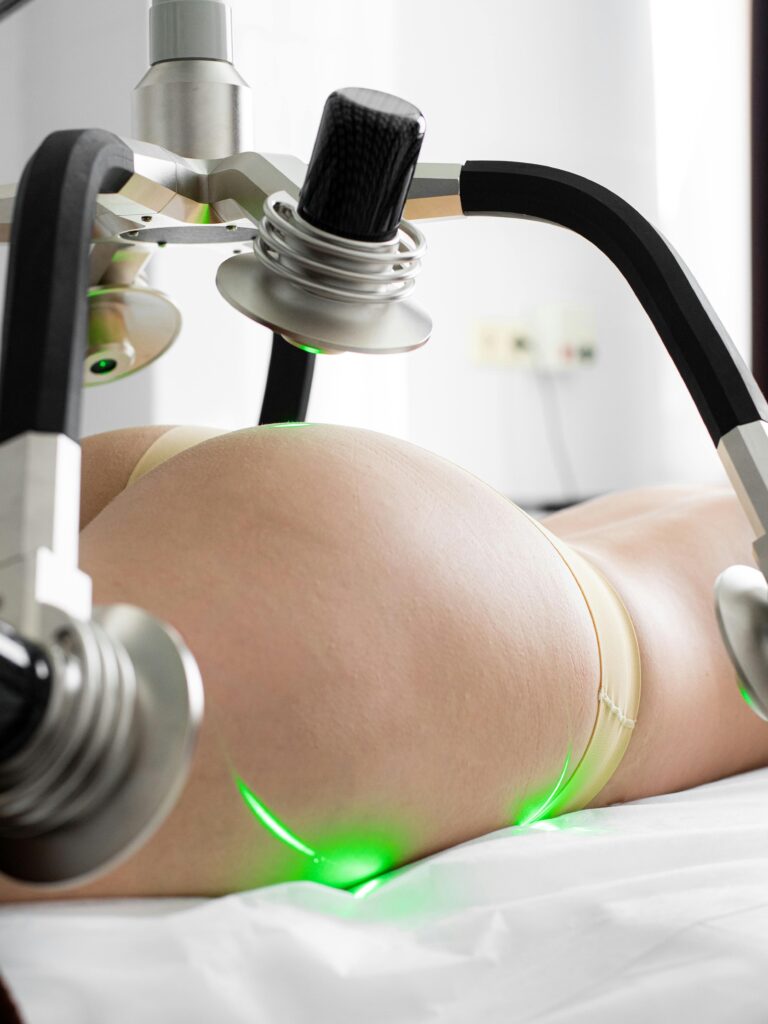 Crop unrecognizable female doing non invasive laser body shaping treatment in modern clinic